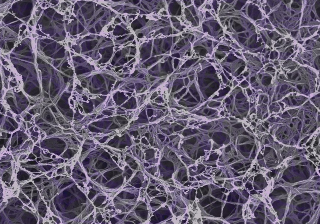 Biomimetic Nanofiber Composites