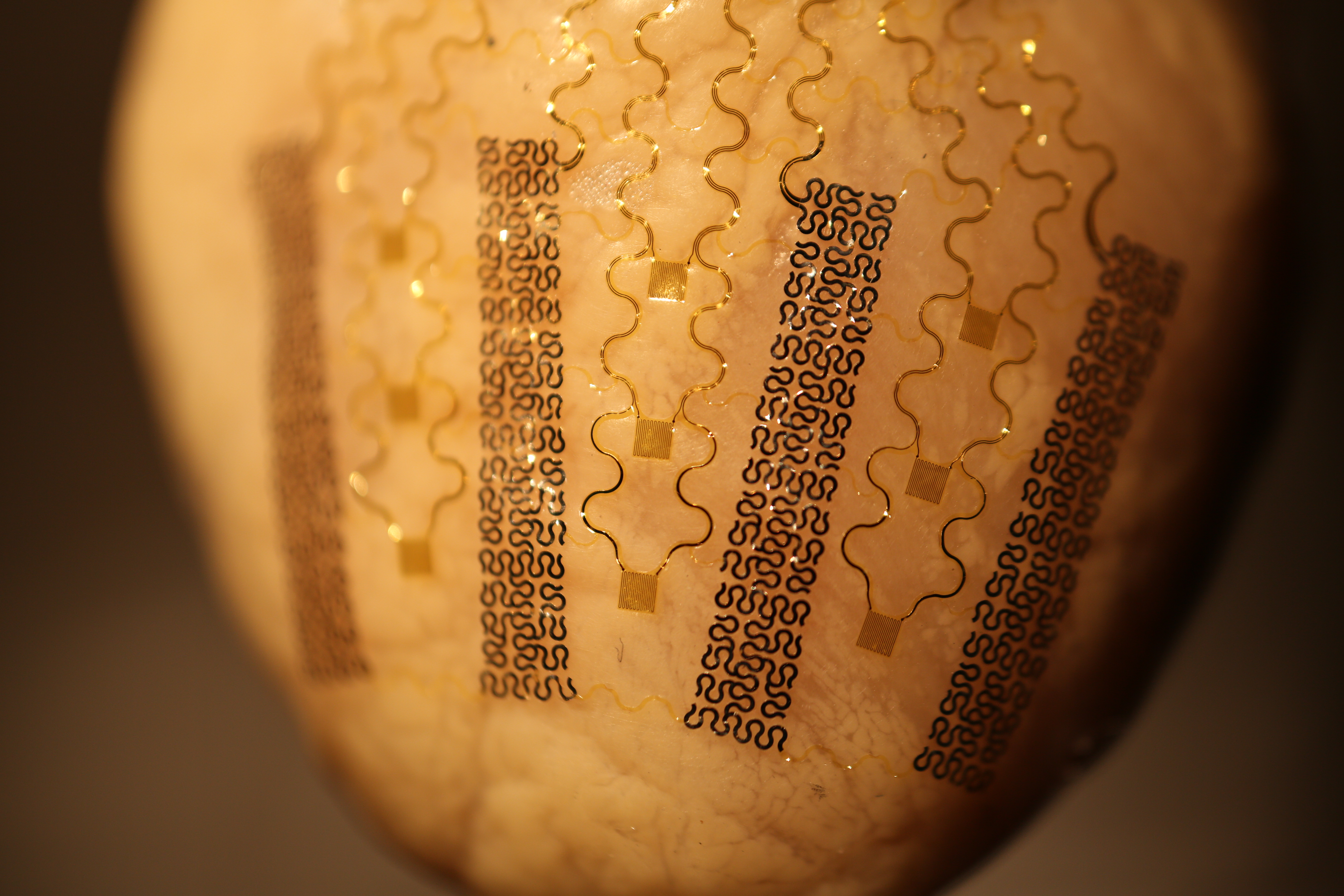 Conformal Defibrillator